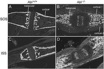 Tissue Nonspecific Alkaline Phosphatase (TNAP) Regulates Cranial Base Growth and Synchondrosis Maturation